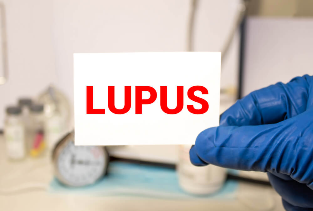 lupus como tratar doenças 