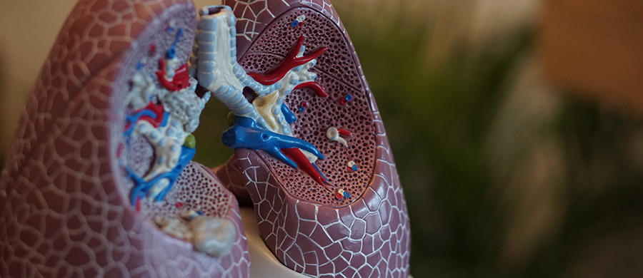 THC e CBN inibem crescimento de câncer de pulmão