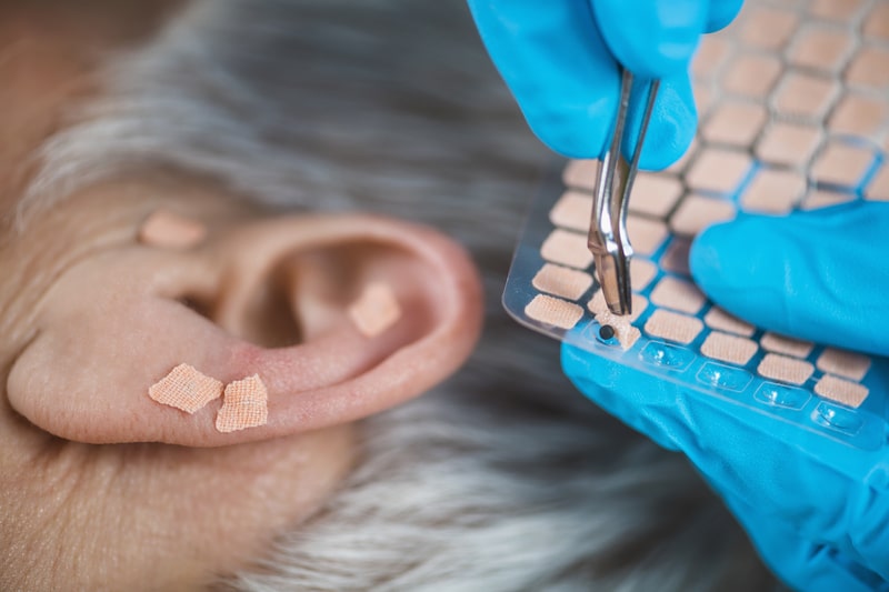 beneficios da acupuntura orelha