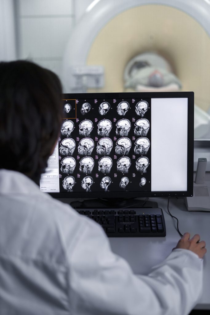 Médico avalia exames em cérebro de paciente