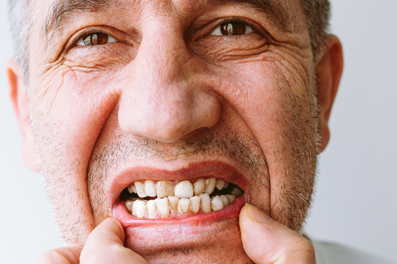 biofilme dental dentes