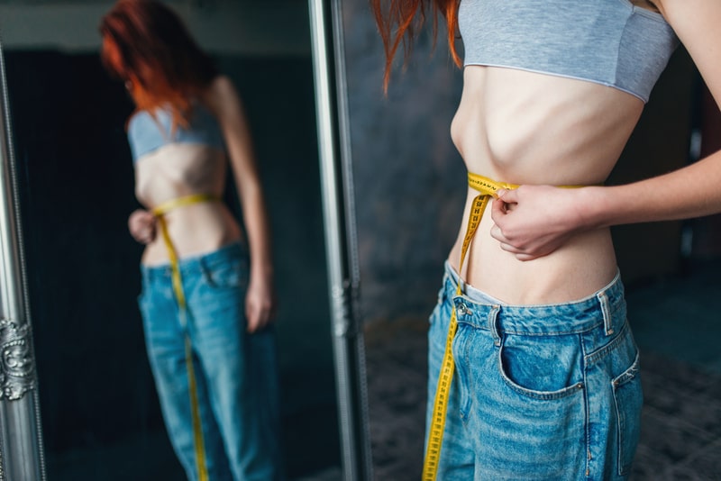 caquexia mulher con anorexia