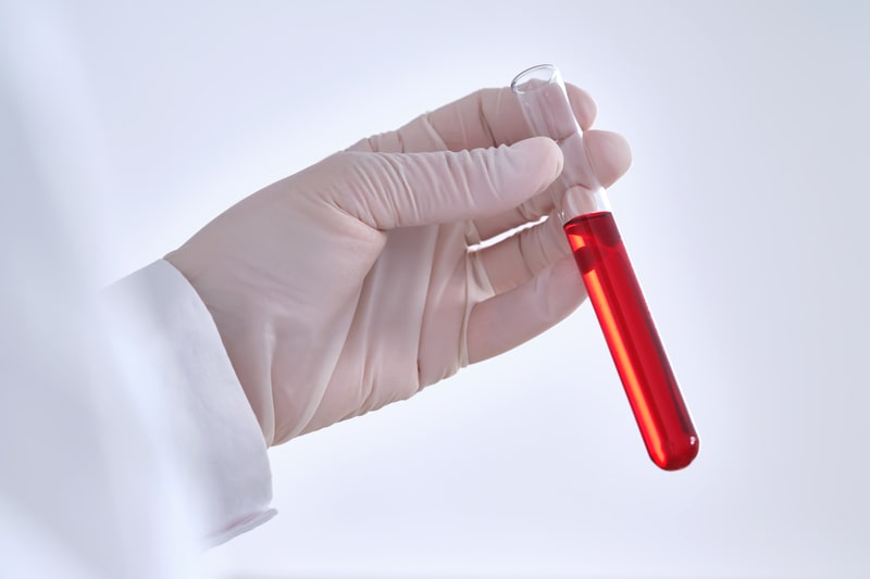 esclerose lateral amiotrofica amostra de sangue
