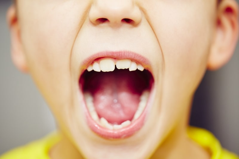 odontogenese dentes de crianca