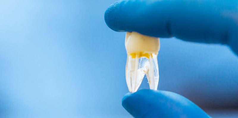 odontogenese estrutura dental