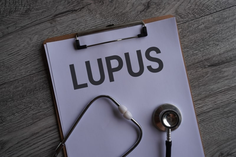 doencas autoimunes lupus