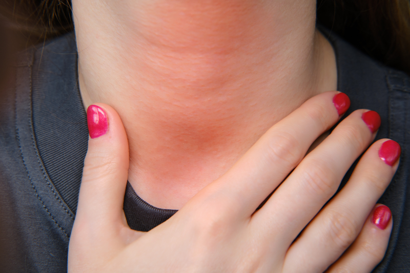 alergia-emocional-sintomas