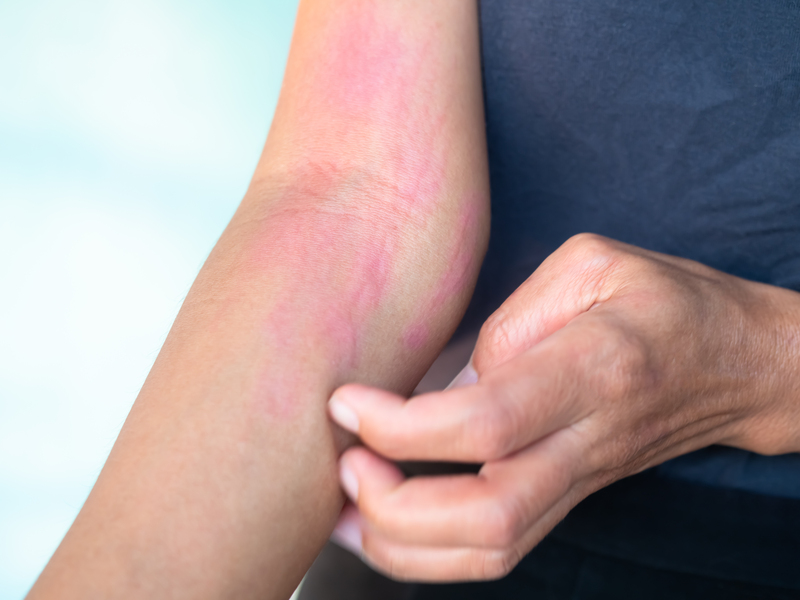 inflamacao cronica como resolver