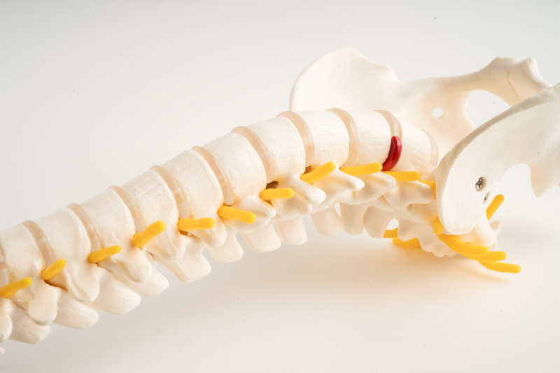 tratamentos para espondilose