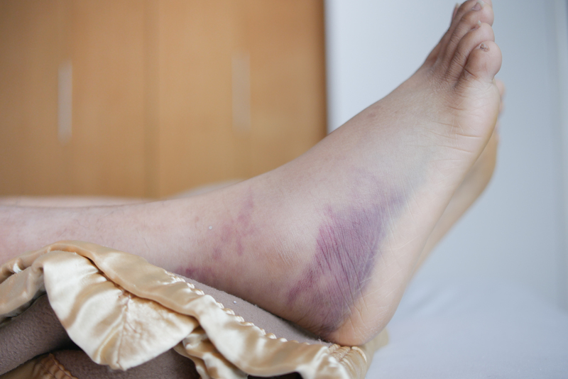 tratamento da erisipela bolhosa