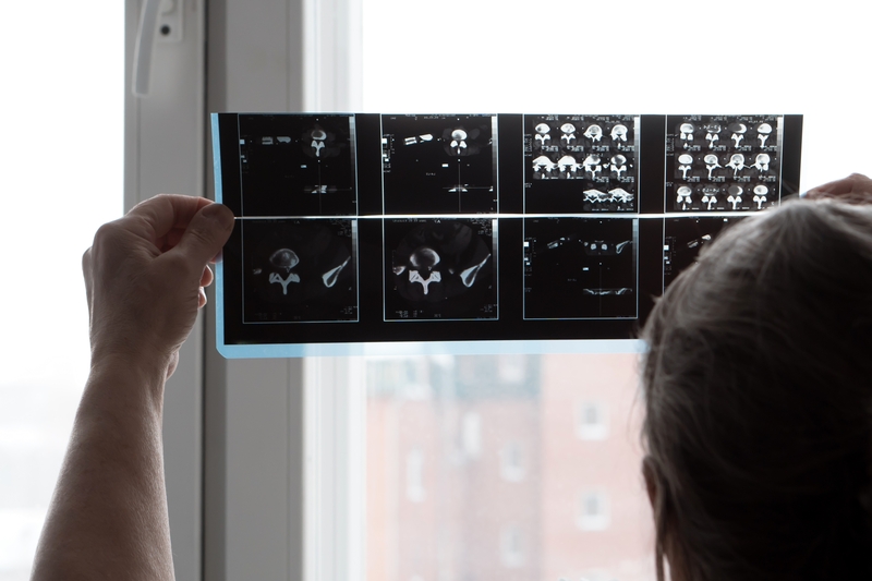 artrose tratamentos naturais raio x