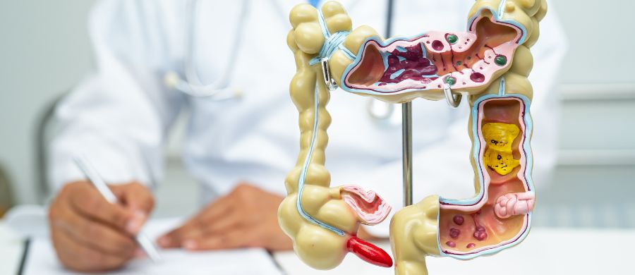 Cannabis pode inovar o tratamento de doenças gastrointestinais