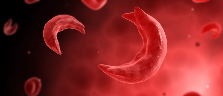 Estudo de caso: CBD e o alívio da dor na doença falciforme