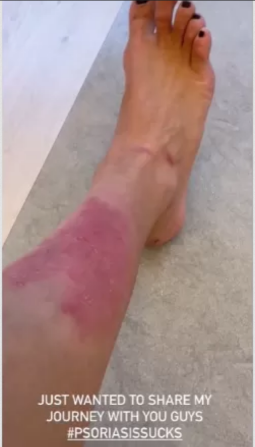 "Gostaria de compartilhar com vocês a minha jornada" escreveu Kim Kardashian | Foto: Instagram