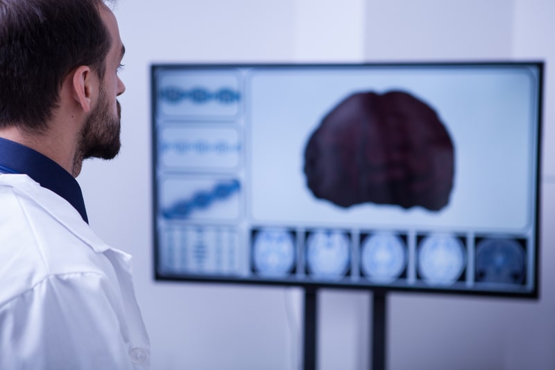 crises de epilepsia diagnostico