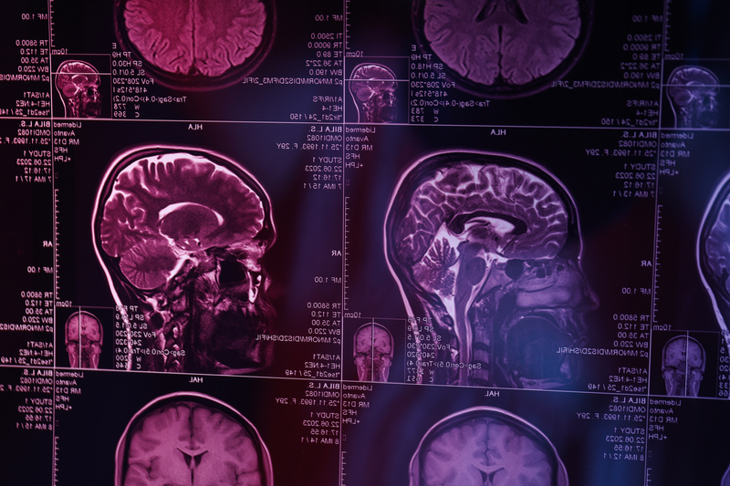 diagnostico das doencas do sistema nervoso