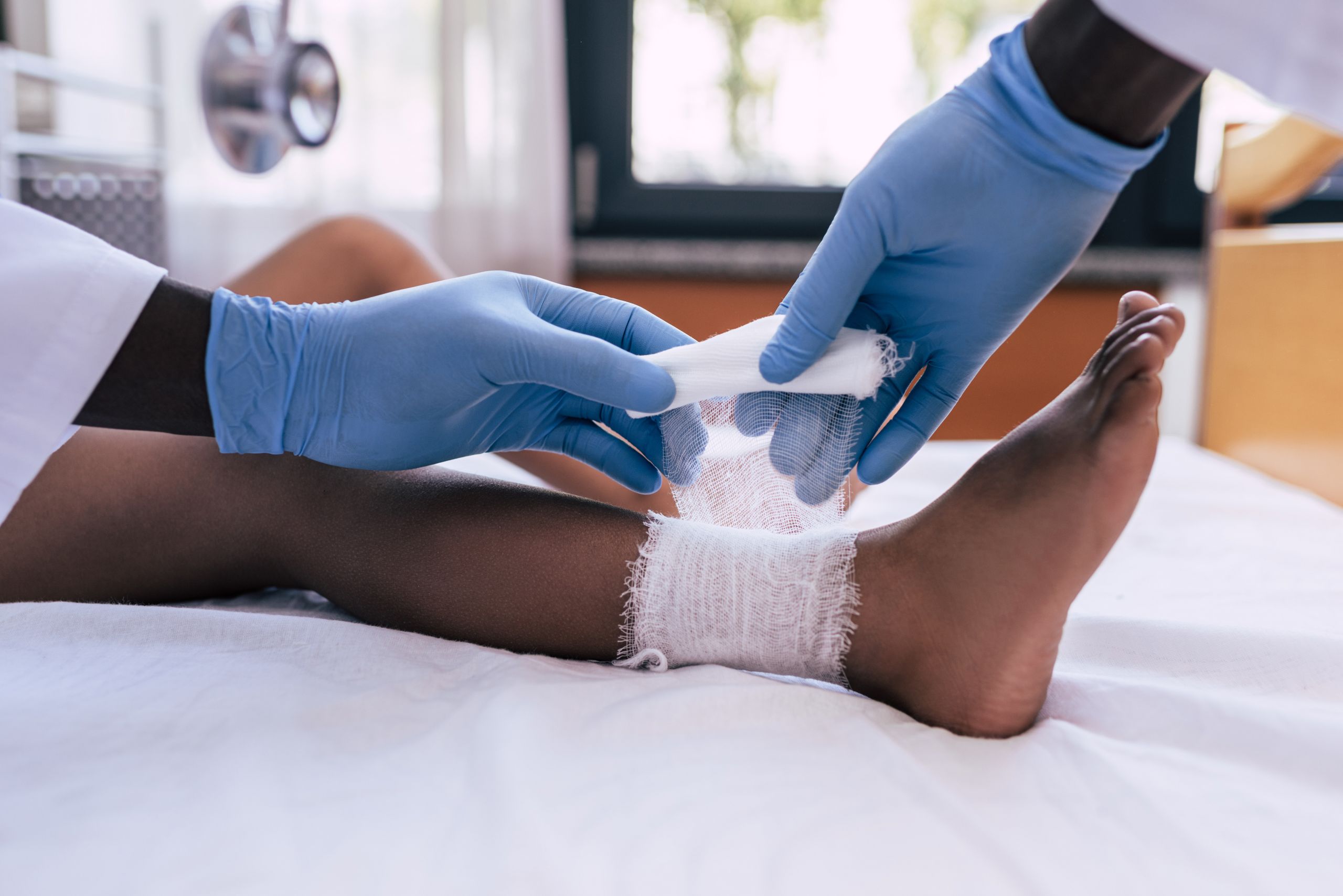 diagnostico e tratamento da erisipela