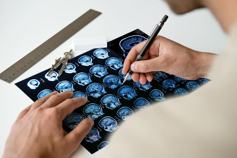 diagnostico para dor de cabeça