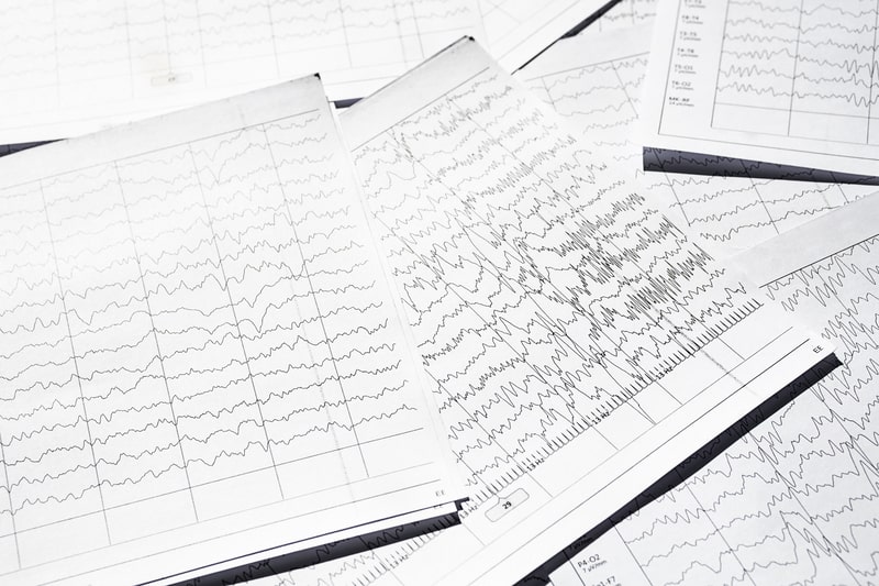epilepsia focal sinais vitais no papel