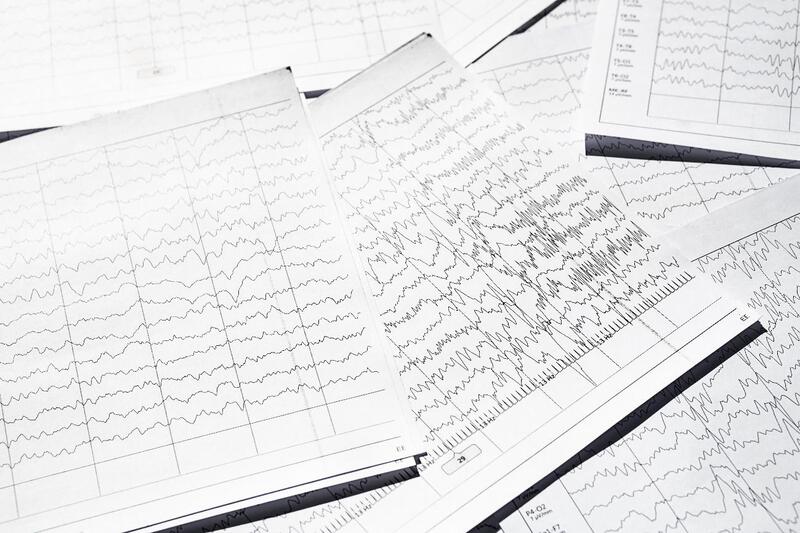 epilepsia refrataria exame cardiovascular