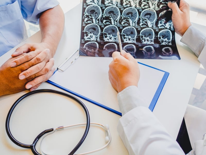 esclerose hipocampal consulta