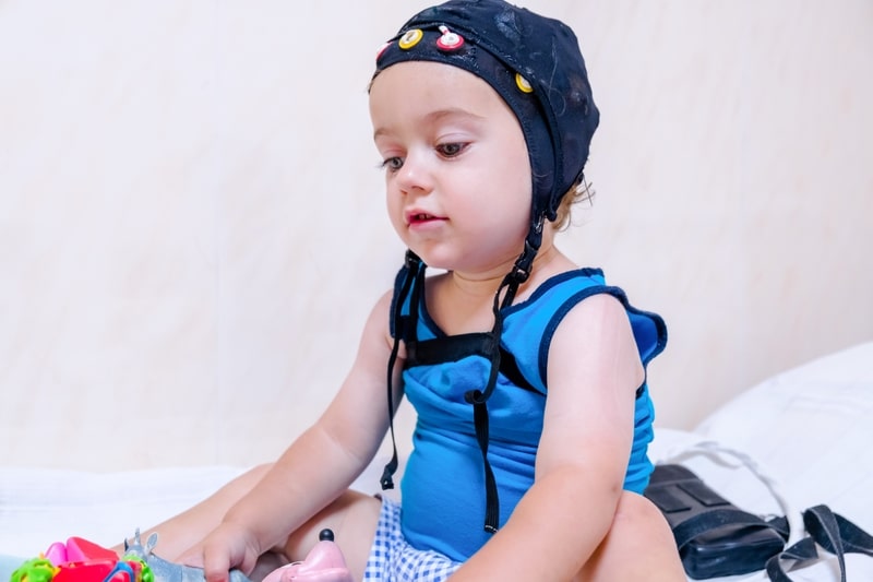 neurologista canabidiol autismo crianca