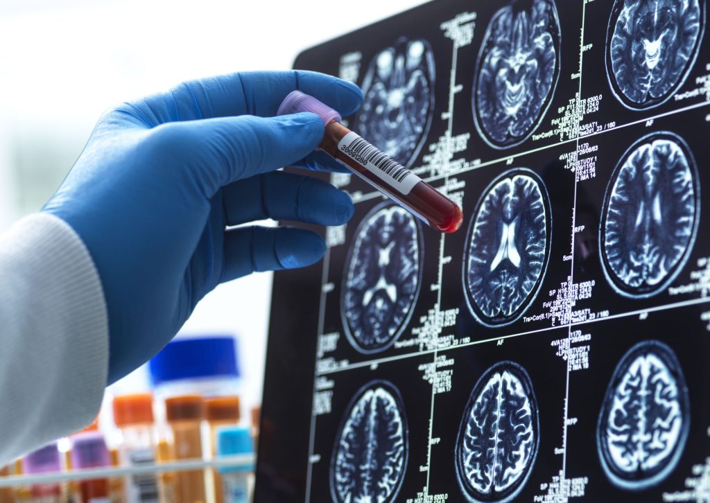 CB1: cientistas identificam como ele protege cérebro contra depressão e estresse