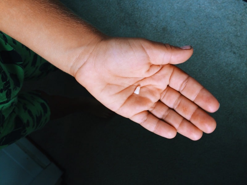 odontogenese dente deciduo