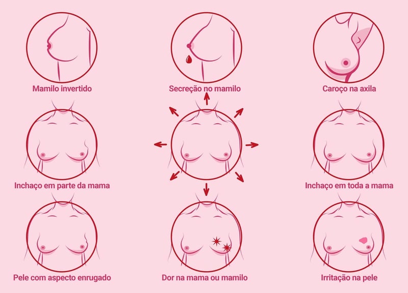 outubro rosa como identificar