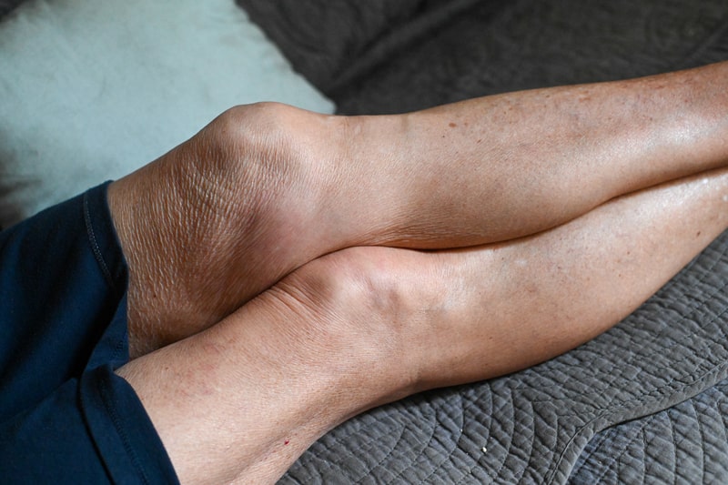 remedio para tendinite patelar