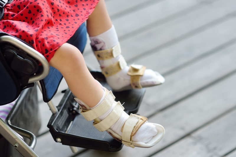 sindrome de rasmussen perna infantil