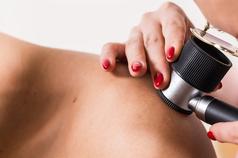 tratamento para cancer de pele sintomas