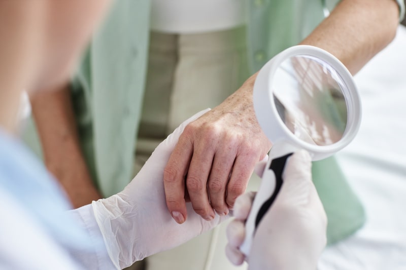 tratamento psoriase consulta