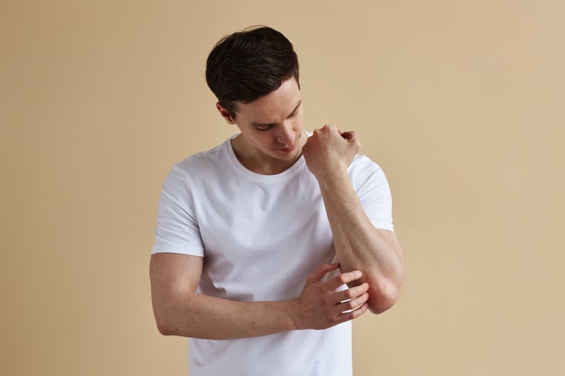 tratamento psoriase ferida no antebraco