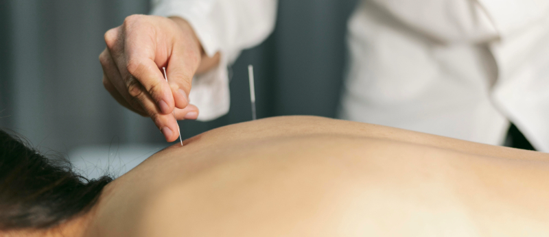 Cannabis e Medicina Tradicional Chinesa