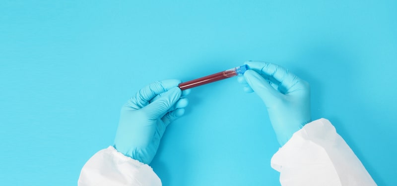 doenca falciforme tubo de sangue