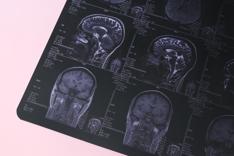 neurodesenvolvimento infantil