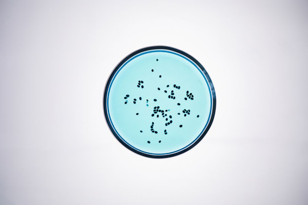 Vista de cima de uma placa petri com bactérias