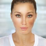 Canabinol e hiperpigmentação: estudo revela potencial clareador do CBN