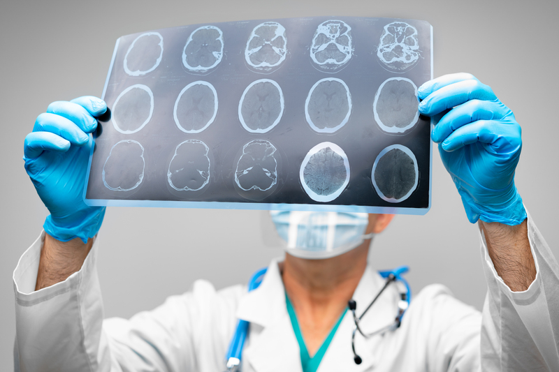 tratamentos para a doença de huntington