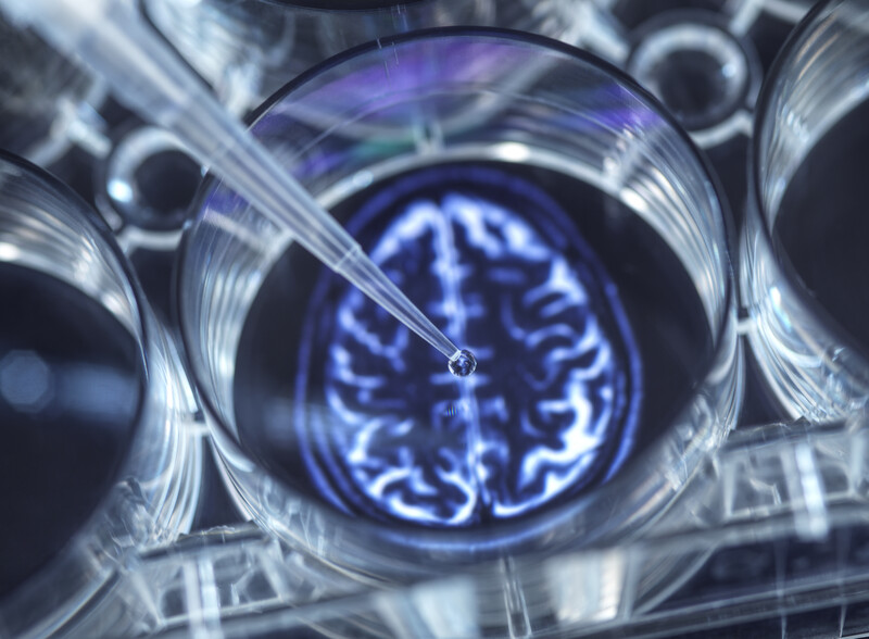 o que e neuroplasticidade