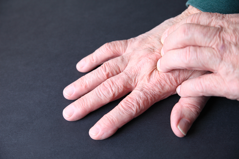 sintomas de artrite e artrose