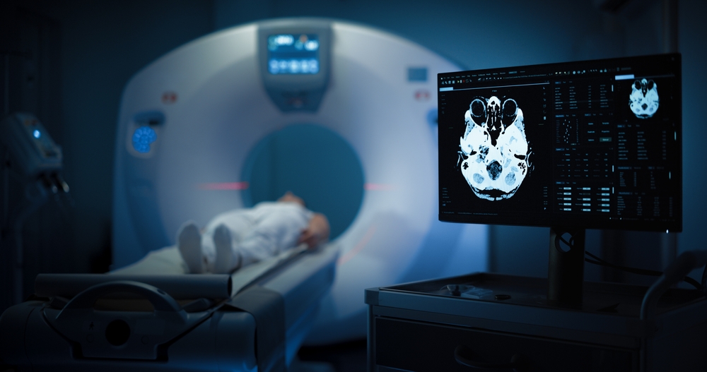Relato clínico sugere potencial do canabidiol no glioblastoma